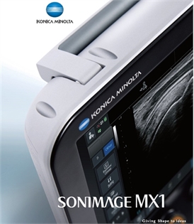 SONIMAGE MX1 - Portable ultrasound 